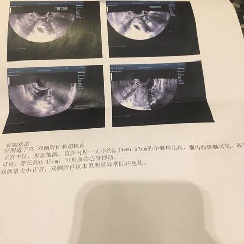 journal_insert_pic_637012787