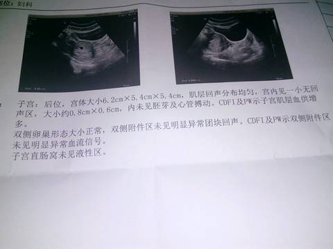 journal_insert_pic_639058105