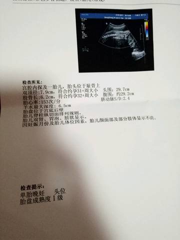 journal_insert_pic_639107036