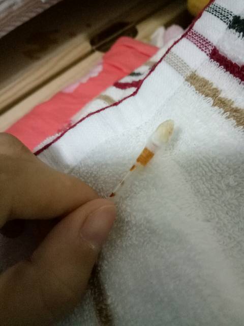 新生儿宝宝脐带有渗液,请问哪位宝妈知道省妇幼挂哪科