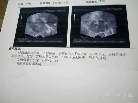 journal_insert_pic_643162171