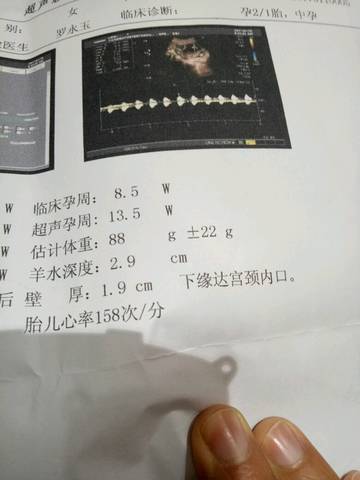 journal_insert_pic_644578442