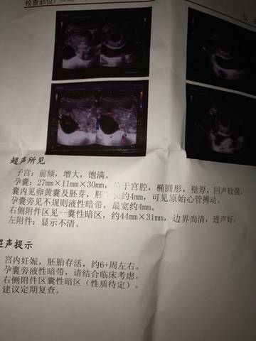 journal_insert_pic_646112128