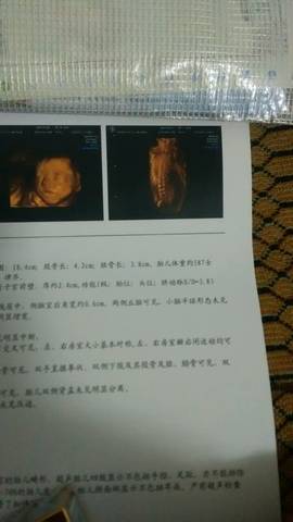 journal_insert_pic_646604938