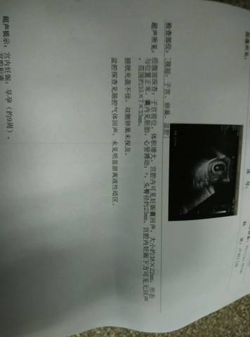 journal_insert_pic_649454783