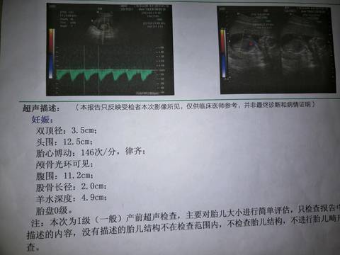 journal_insert_pic_651044878