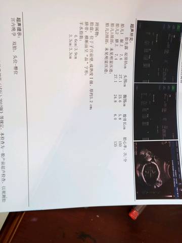 journal_insert_pic_653082696