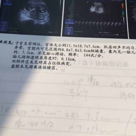 journal_insert_pic_654520875
