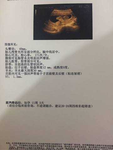journal_insert_pic_655251952