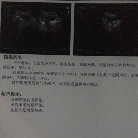journal_insert_pic_655939007