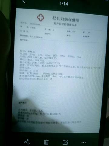 journal_insert_pic_655656450