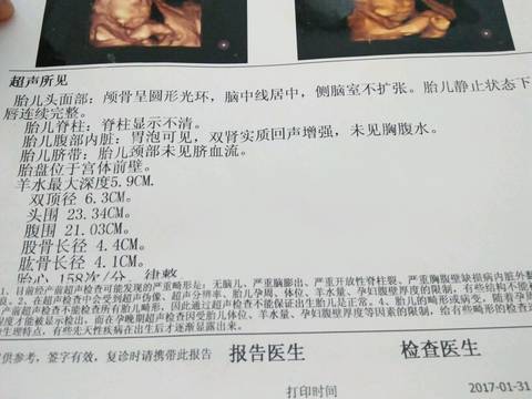 journal_insert_pic_659797781