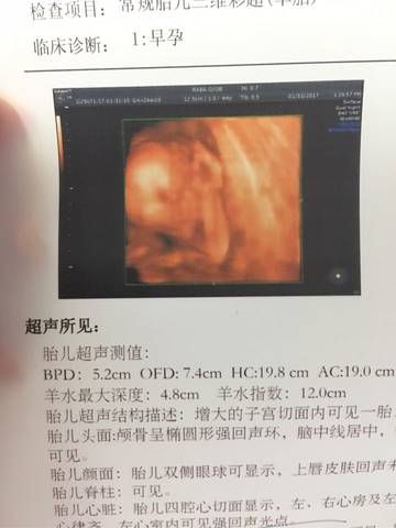journal_insert_pic_659751721