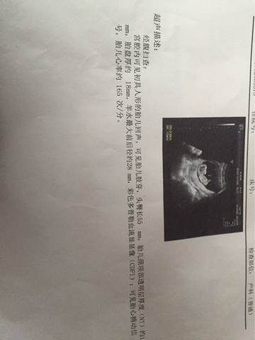 journal_insert_pic_661839848
