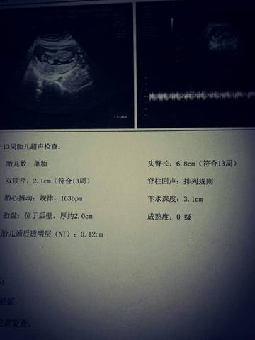 journal_insert_pic_661927125