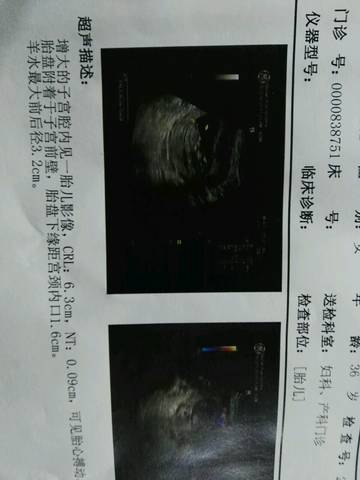 journal_insert_pic_662325085