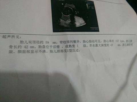 journal_insert_pic_663168414