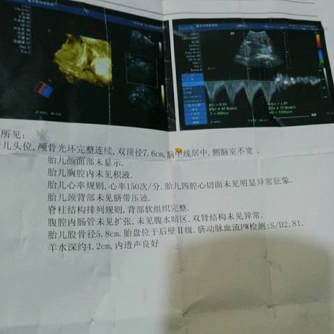 journal_insert_pic_666931417