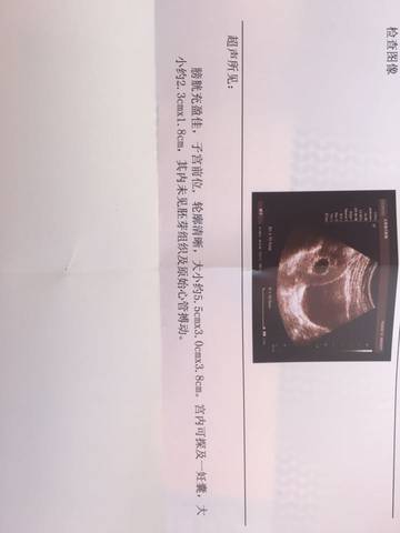 journal_insert_pic_667774129
