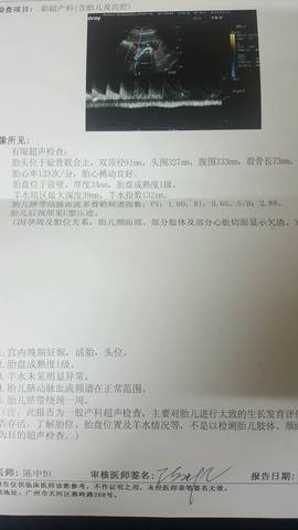 journal_insert_pic_668257174