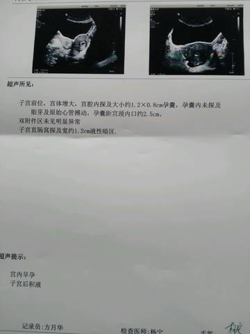 journal_insert_pic_669855544