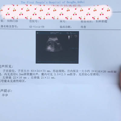 journal_insert_pic_670881185