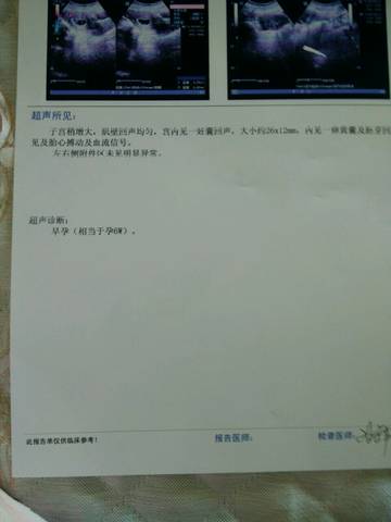 journal_insert_pic_673528312