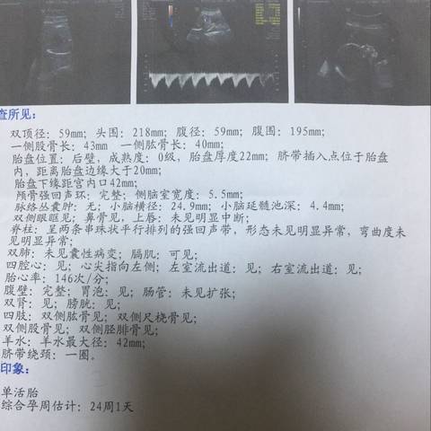 journal_insert_pic_673444522