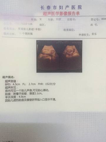 journal_insert_pic_677835652