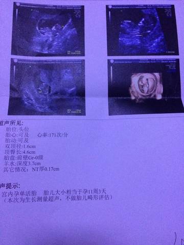 journal_insert_pic_679600841