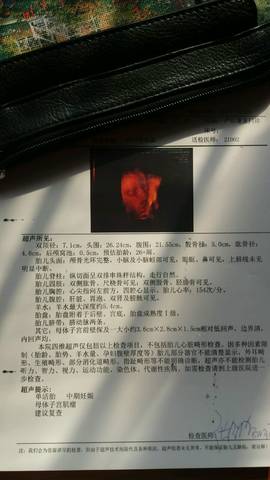 journal_insert_pic_679307393