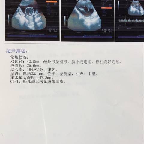 journal_insert_pic_679981883