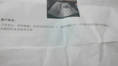 journal_insert_pic_680325007