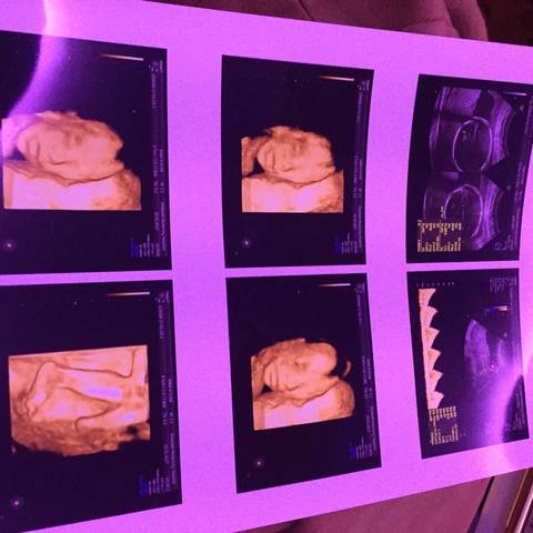 journal_insert_pic_681096126