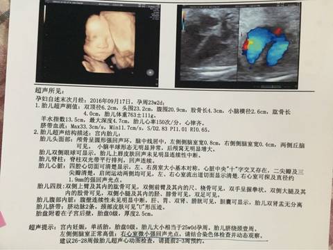 journal_insert_pic_682041732
