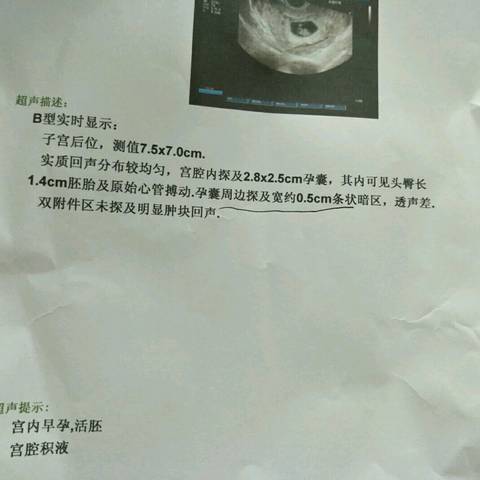journal_insert_pic_682909390