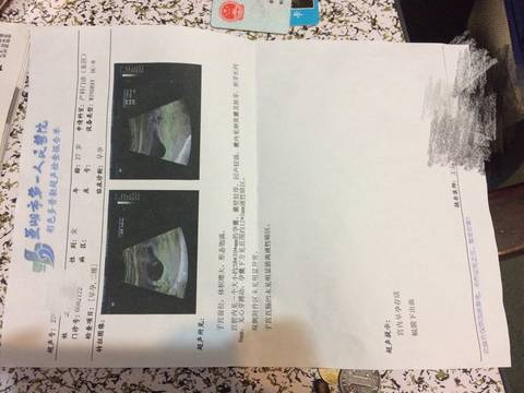 journal_insert_pic_683172601