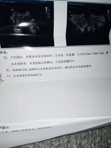 journal_insert_pic_683448361