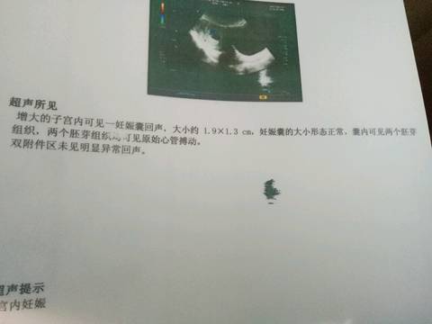 journal_insert_pic_684183882