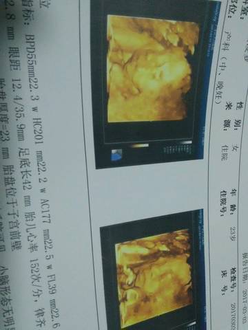 journal_insert_pic_685267203