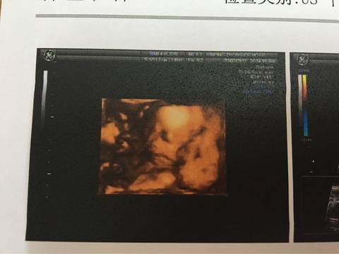 journal_insert_pic_685629181