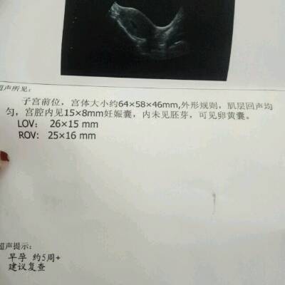 journal_insert_pic_687587119