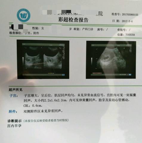 journal_insert_pic_687585180