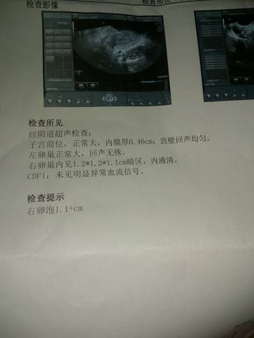 journal_insert_pic_689726458