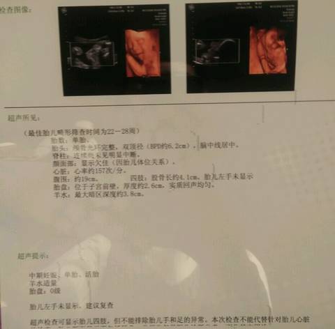journal_insert_pic_690329177