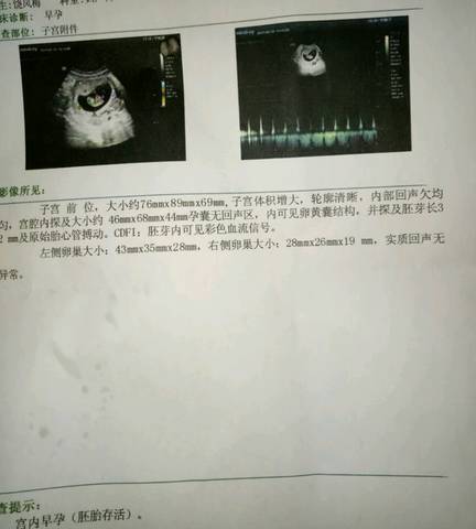 journal_insert_pic_692581420
