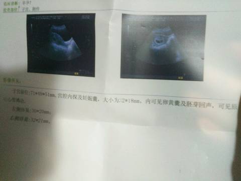 journal_insert_pic_697172908