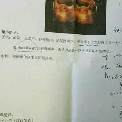 journal_insert_pic_697700683