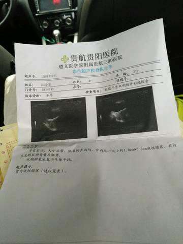贵阳妇科炎症治疗：选择正确的方式很重要