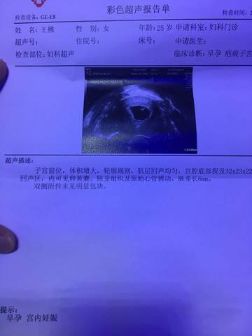 journal_insert_pic_699393791